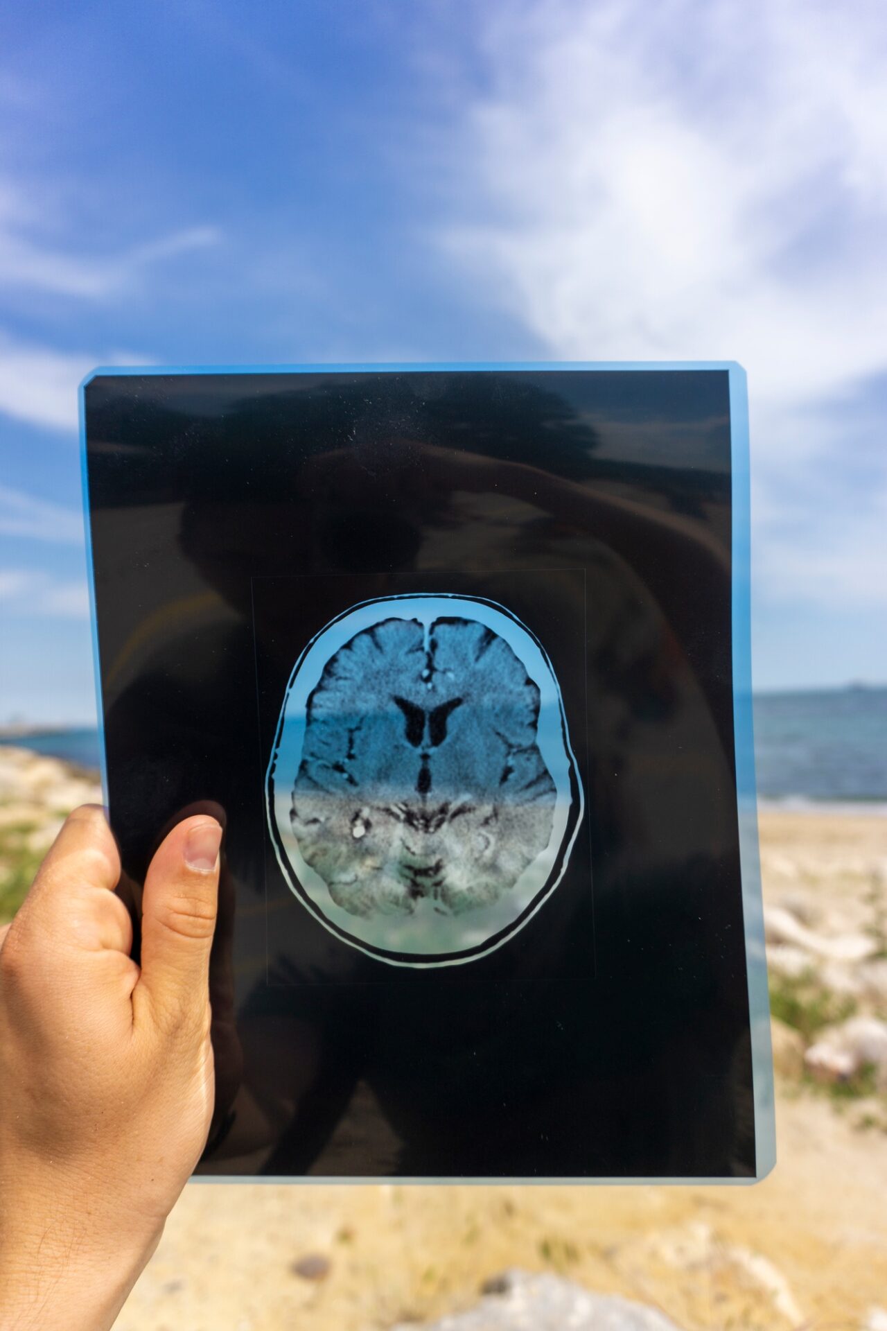 Vertical shot of a hand holding a transparent brain scan on a beach